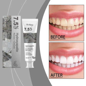 7.5% Nano Hydroxyapatite Fluoride Toothpaste for Teeth Whitening